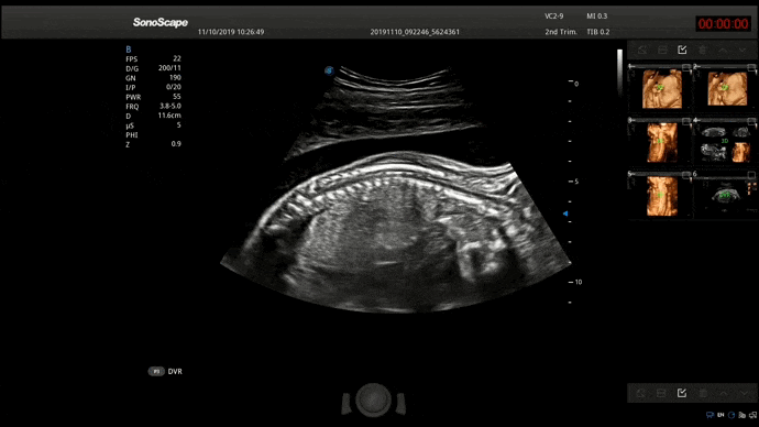 S-Spine 3D