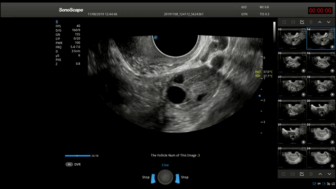 S-Follicle
