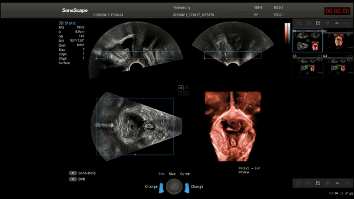 S-Pelvic 3D-4D