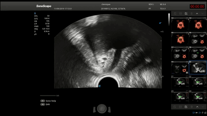 S-Pelvic 2D
