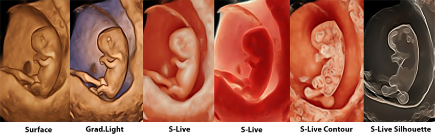 Ginecología, S-Live