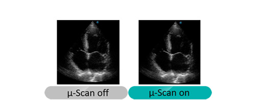 Scan