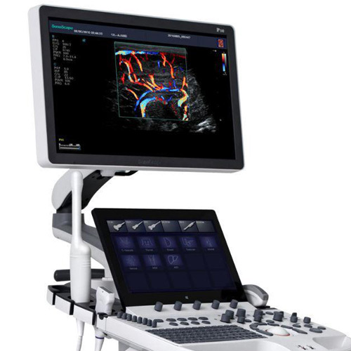 Sonoscape P40 ELITE