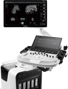 SonoScape Marvo S80 Elite